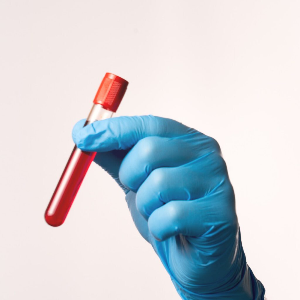 A gloved hand holding a blood sample tube