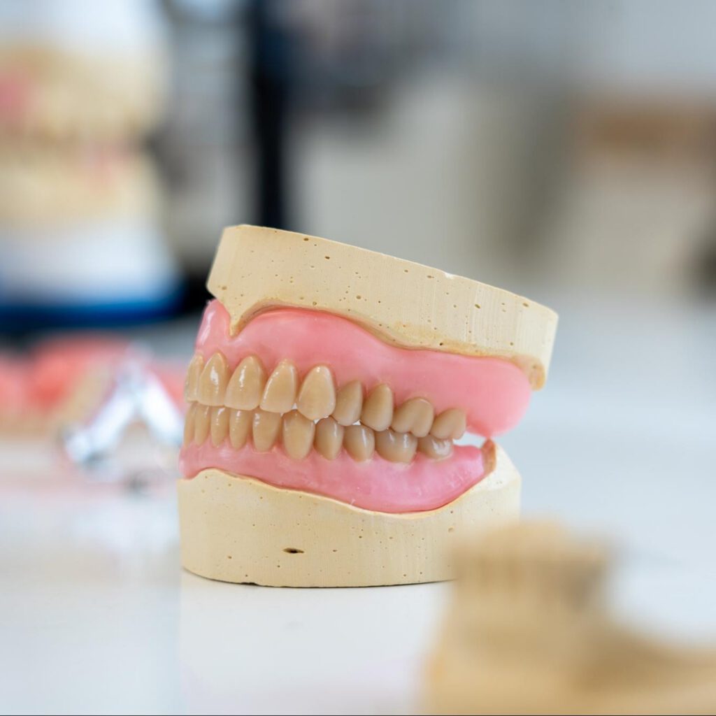 A full set of dentures on a laboratory model